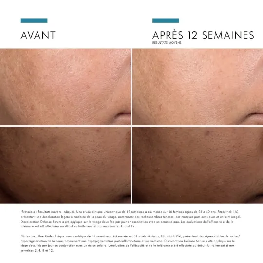 SkinCeuticals Discoloration Defense Sérum 30ml SkinCeuticals Discoloration Defense Sérum 30ml