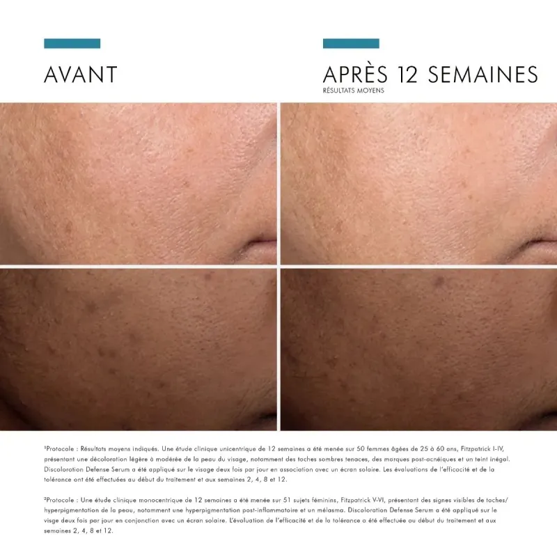 SkinCeuticals Discoloration Defense Sérum 30ml SkinCeuticals Discoloration Defense Sérum 30ml