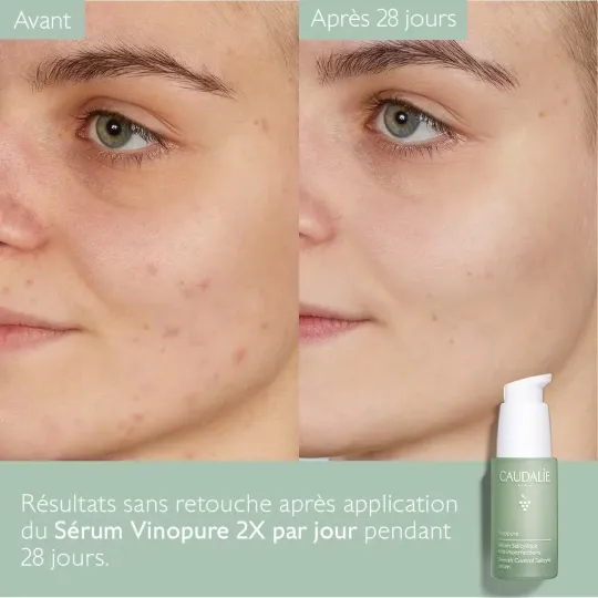 Caudalie Vinopure Sérum Salicylique Anti-imperfections 30ml Caudalie Vinopure Sérum Salicylique Anti-imperfections 30ml