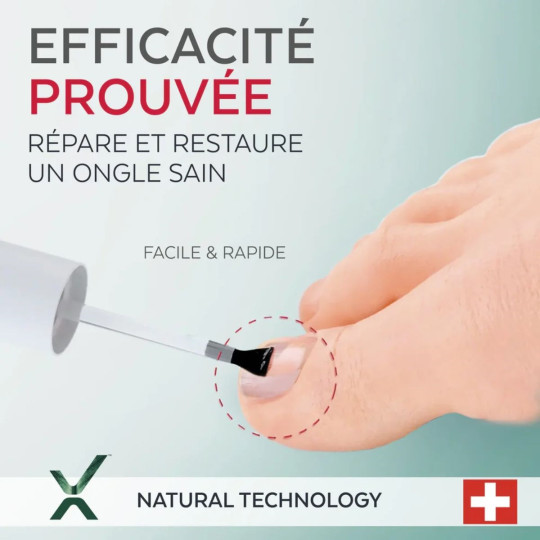 Poderm Sérum Ongles Striés, Cassants, Dédoublés Poderm Sérum Ongles Striés, Cassants, Dédoublés