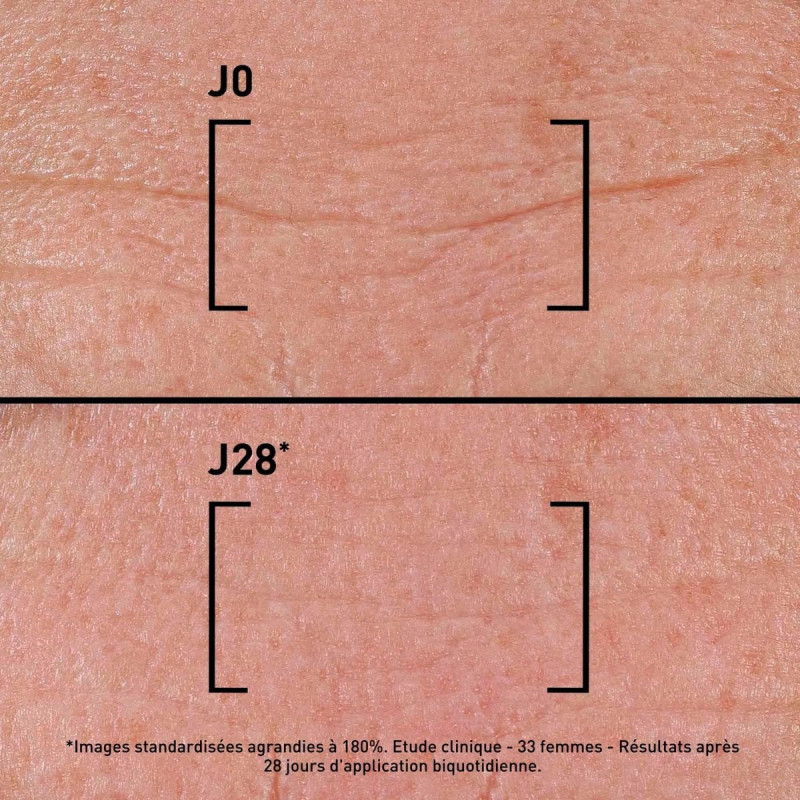 Filorga Time-filler Intensive 5XP